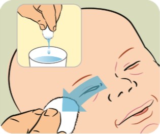 Graphic explanation of how to clean baby's eyes.</body></html>